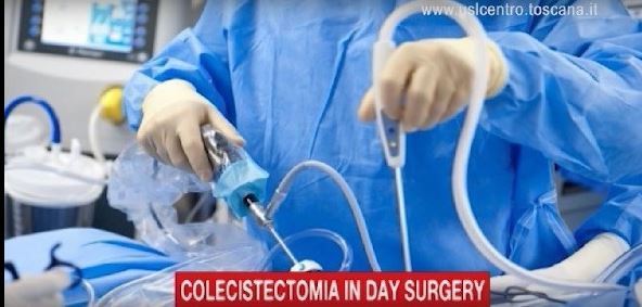 Colecistectomia in day surgery  “dimissioni in un giorno”