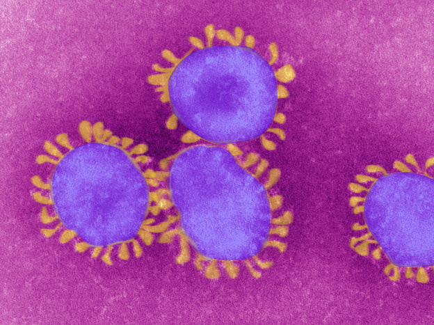 Coronavirus(FontefotoRegioneToscana) 