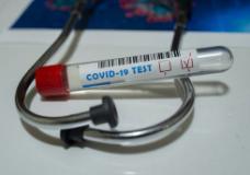 Regione. Coronavirus: 2 decessi, 1 nuovo caso, 3 guarigioni