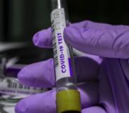 Coronavirus (Foto di repertorio)