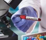 Coronavirus (Foto di repertorio)