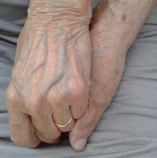 Caregiver - (Fonte foto Loriana Curri - Met Ufficio Stampa)