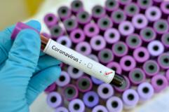 Coronavirus: 1.708 nuovi casi, età media 48 anni, 7 decessi