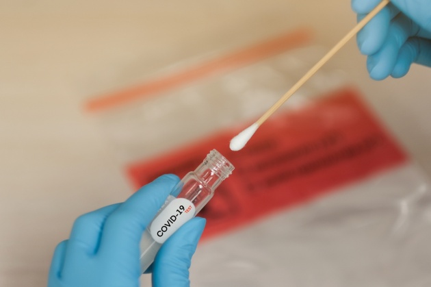 Coronavirus (Foto di repertorio)