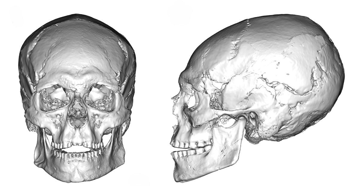 cranio di 12mila anni fa conservato nel Museo di Antropologia